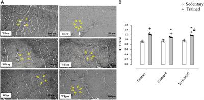 Exercise-induced angiogenesis is attenuated by captopril but maintained under perindopril treatment in hypertensive rats